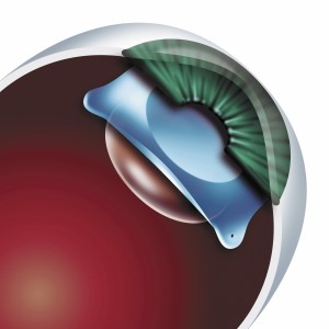 eye w icl _animation_ small  